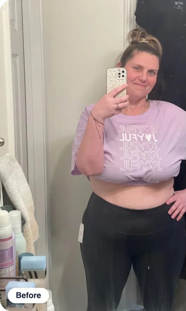 Meghan S. before treatment