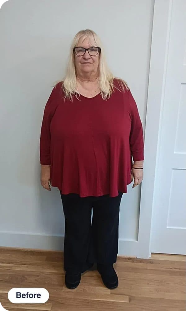 Linda M. before treatment