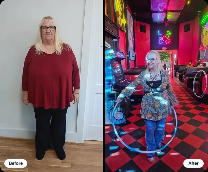 Linda M. before and after treatment with WeightRx