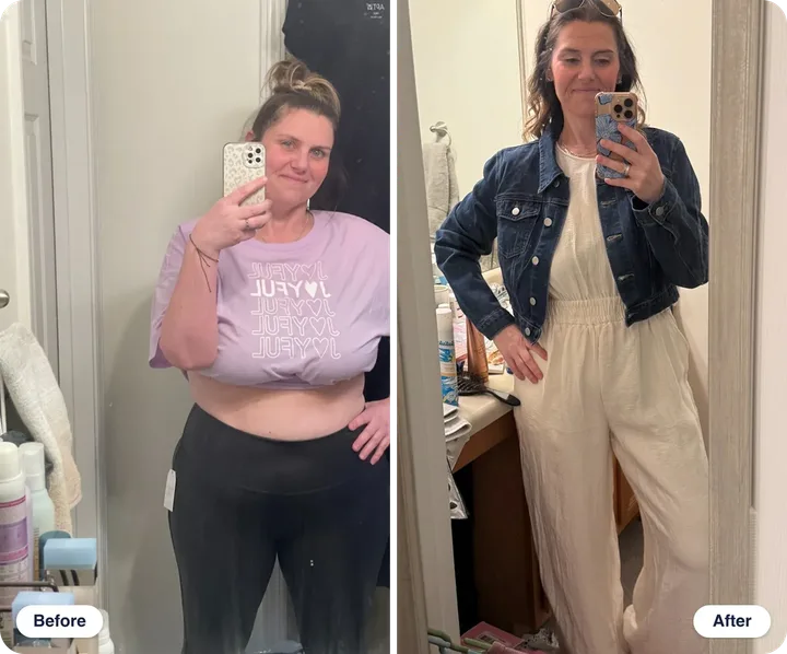 Meghan S. before and after treatment with WeightRx