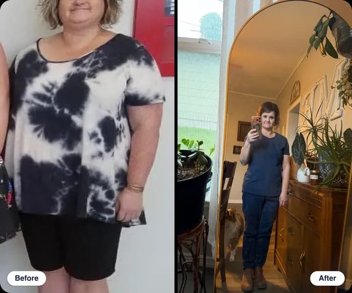 Michelle C. before and after treatment with WeightRx