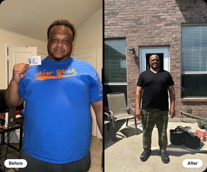 Tim B. before and after treatment with WeightRx
