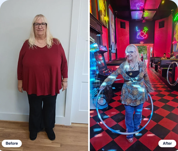 Linda M. before and after