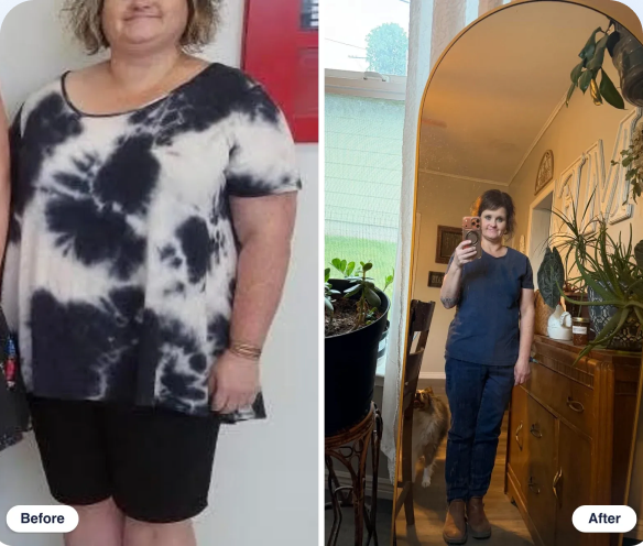 Michelle C. before and after