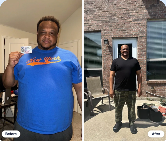 Tim B. before and after